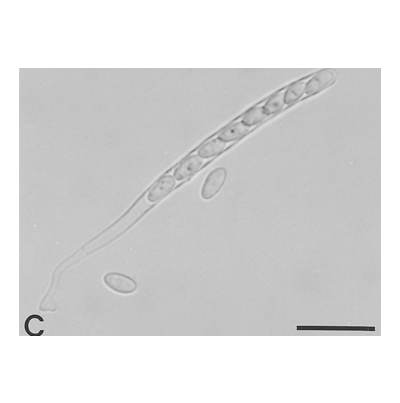 병원균(자낭포자)