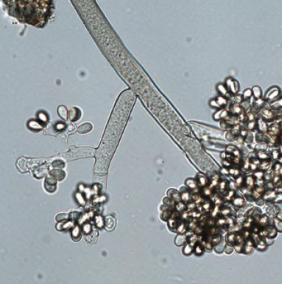 병원균(분생포자)
