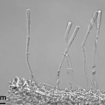 병원균(분생포자)
