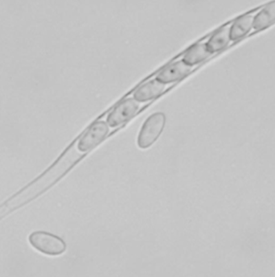 병원균(자낭포자)