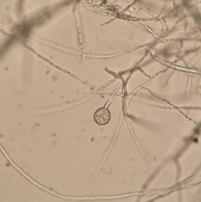 병원균(균사 및 포자)