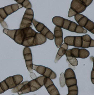 병원균(분생포자)