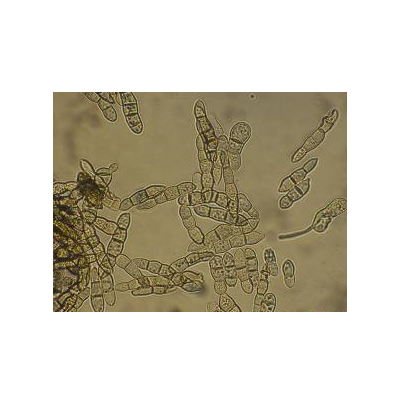 병원균(분생포자)