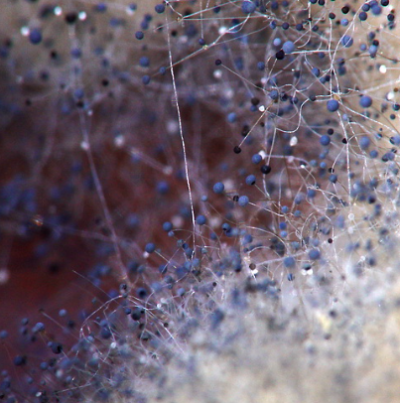 병원균(포자낭)