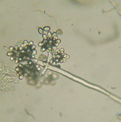 병원균(분생포자)