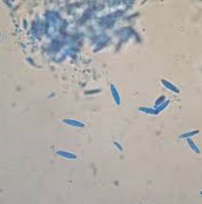 병원균(병포자)