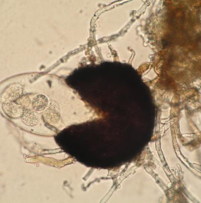 병원균(자낭과 자낭각)