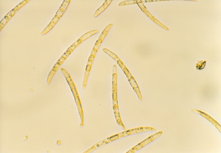 녹두 검은뿌리썩음병 병원균 분생포자