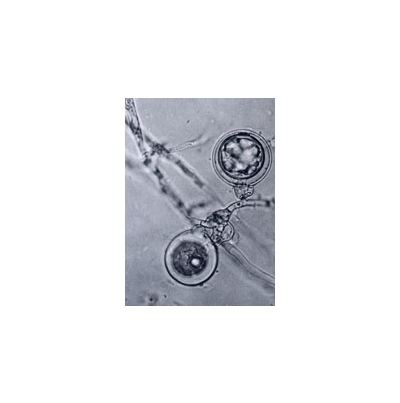 콩 역병 병원균 난포자