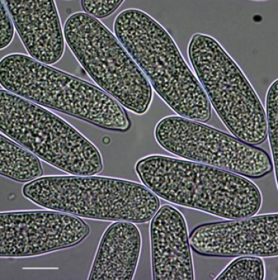 병원균(분생포자)