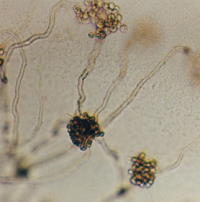 병원균(유주자낭)