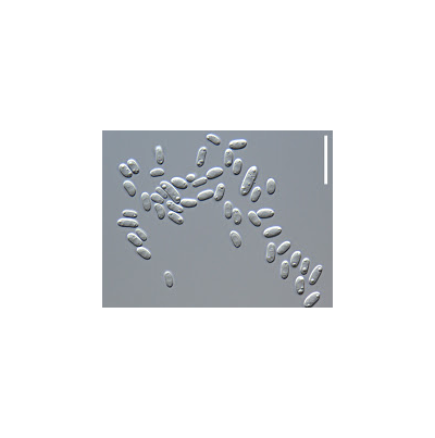 병원균(분생포자, Bar=20㎛)