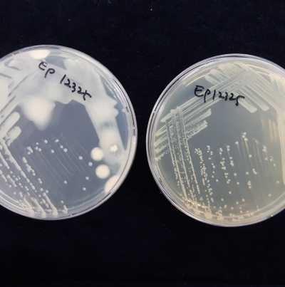 배지 상의 균총(KB 배지(좌) 흘러내릴 정도의 콜로니, TSA 배지(우) 반투명 회백색 콜로니)