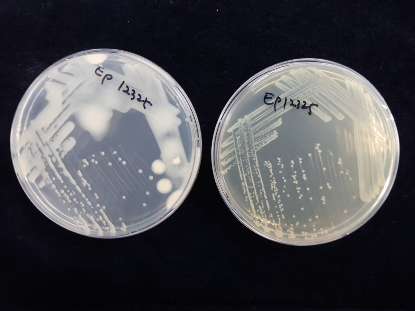 배지 상의 균총(KB 배지(좌) 흘러내릴 정도의 콜로니, TSA 배지(우) 반투명 회백색 콜로니)