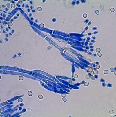 병원균(분생자경 및 분생포자)
