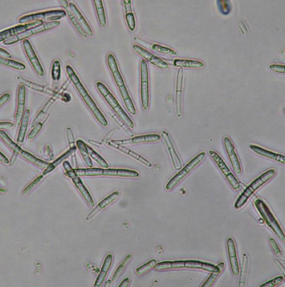 병원균(분생포자)