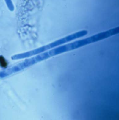 병원균(분생포자)