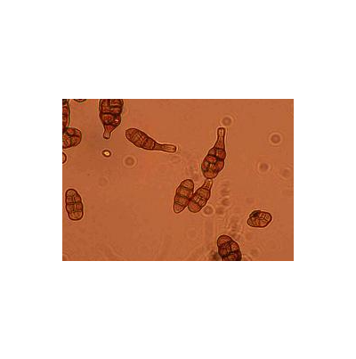 병원균(분생포자)