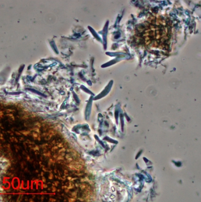 병원균(자낭 및 자낭포자)