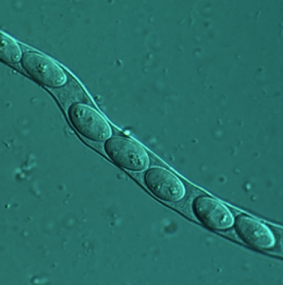 병원균(자낭포자)