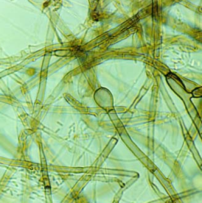 백문우병 균사(격막부위 서양배 모양)