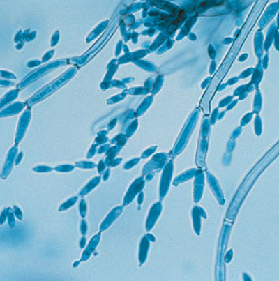 병원균(분생포자)