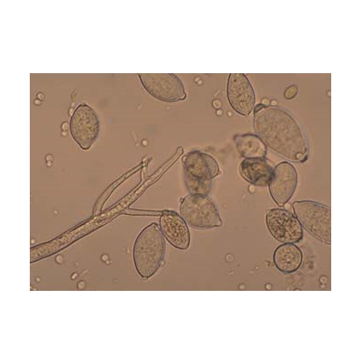 병원균(유주자낭)  