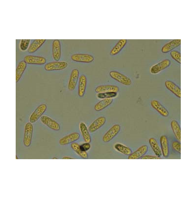 병원균(분생포자)