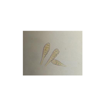 병원균(분생포자)