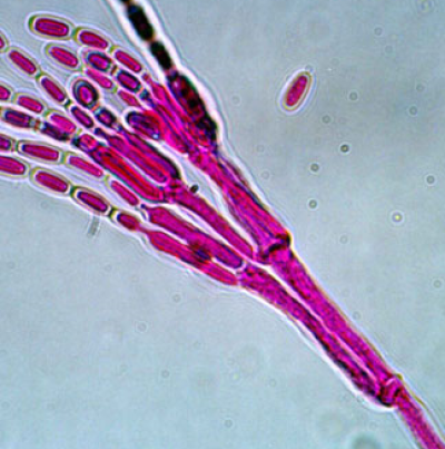 병원균(분생포자)