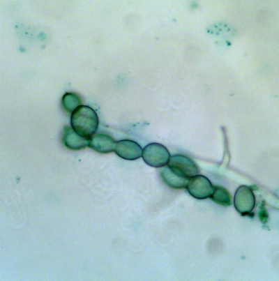 병원균(M. fructicola)분생포자