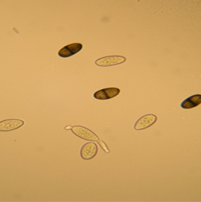병원균(분생포자)