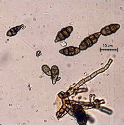 병원균(분생포자)