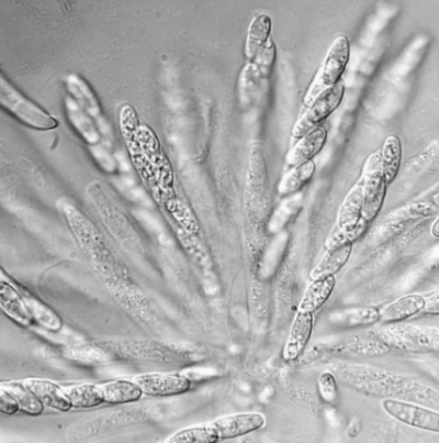 병원균(자낭과 자낭포자)