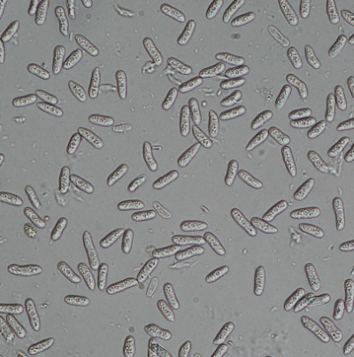 병원균(분생포자) 