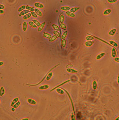   병포자(α, β포자)