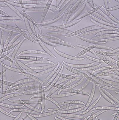 병원균(대형분생포자)