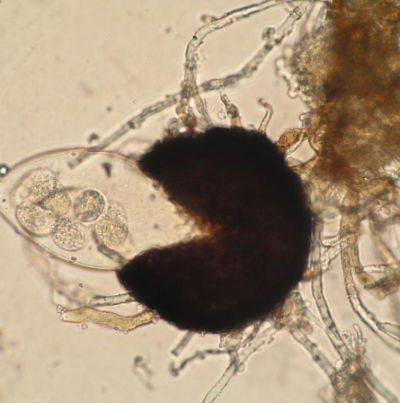 병원균(자낭각과 자낭)