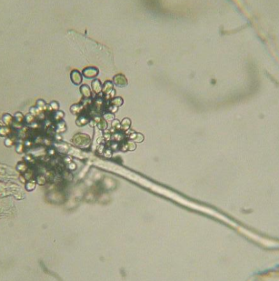 병원균(분생자경 및 분생포자)