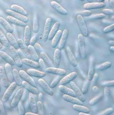 병원균(분생포자)   