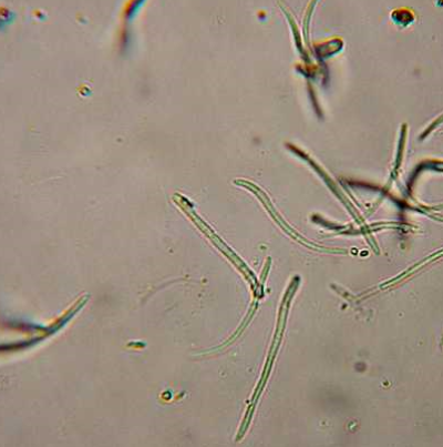 병원균(분생포자)