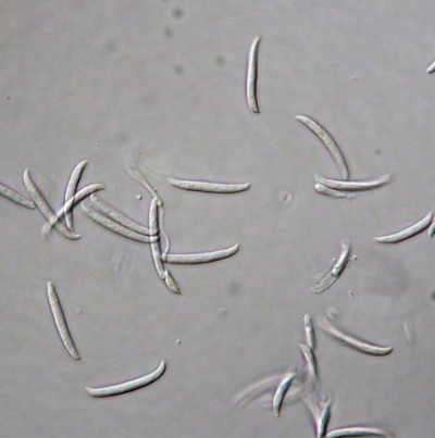 병원균(분생포자)