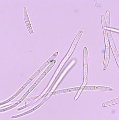 병원균(분생포자)