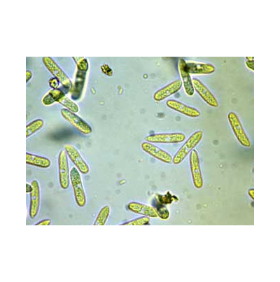 병원균(분생포자)
