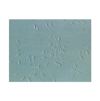 병원균(병포자) 