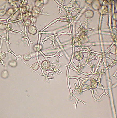 병원균(포자낭병 및 포자낭)