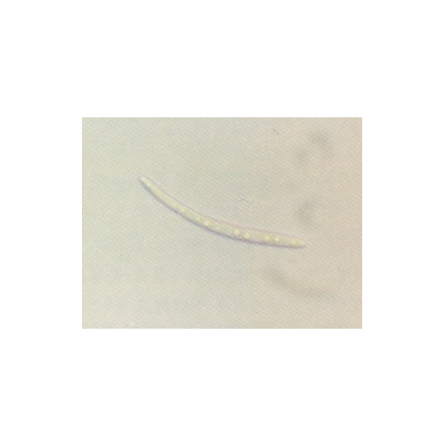 병원균(분생포자)