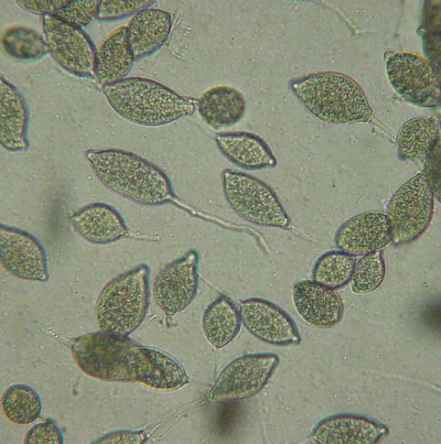 병원균(P. capsici 유주자낭)