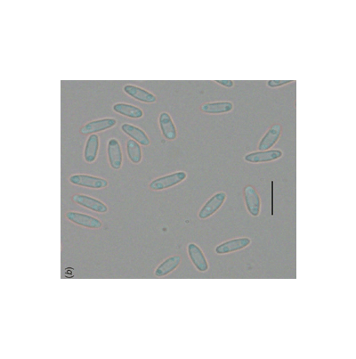 병원균(병포자, Bar=10㎛)