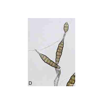 병원균(분생포자)